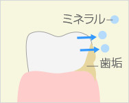 フッ素塗布の流れ1